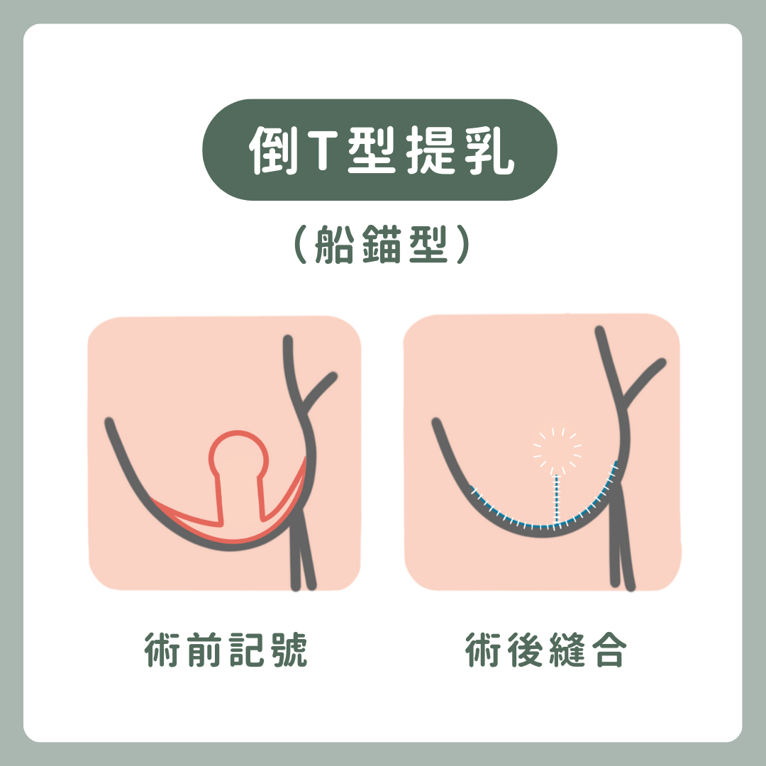 手術前後對比