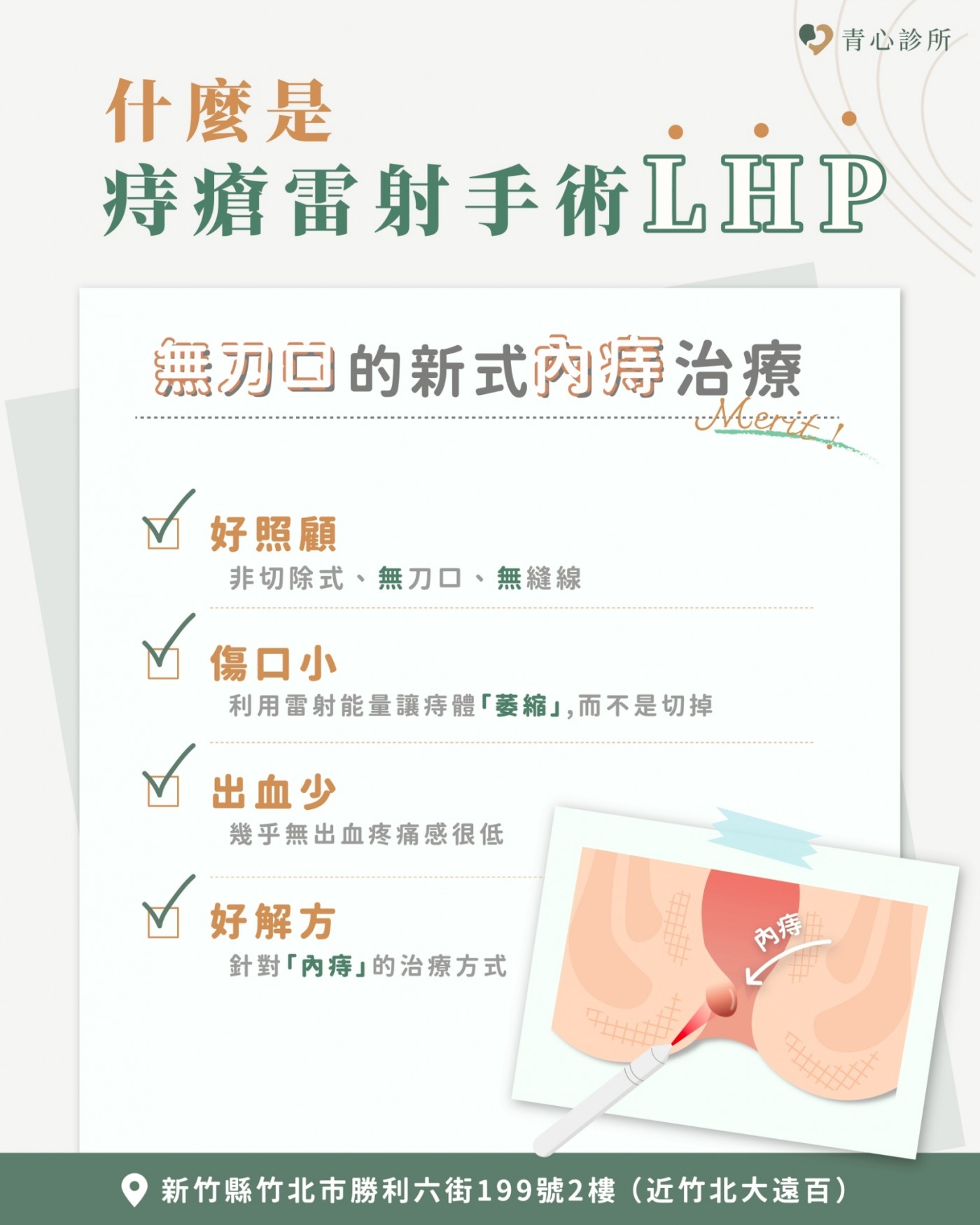 LHP痔瘡雷射手術原理