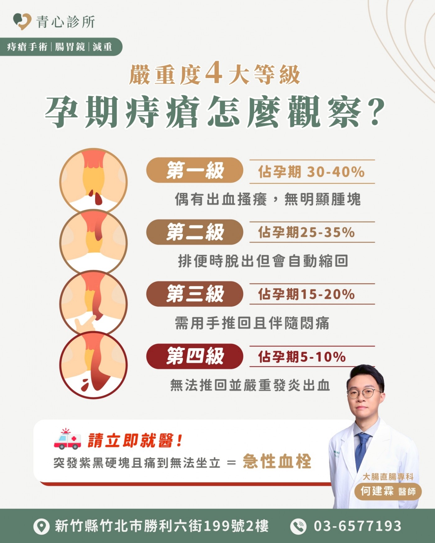 孕期痔瘡 4 大嚴重度等級對照表