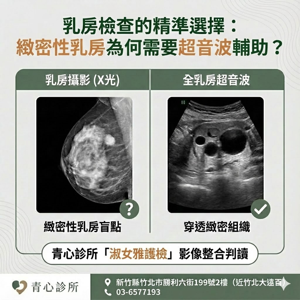 乳房檢查工具比較